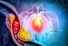 高血压糖尿病高血脂禁忌食物名单